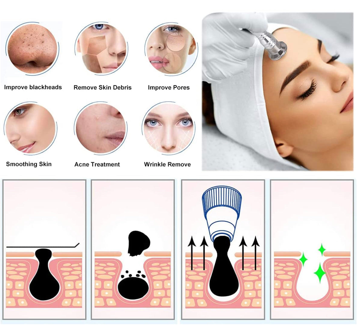 CA DIAMOND MICRO DERMABRASION MACHINE